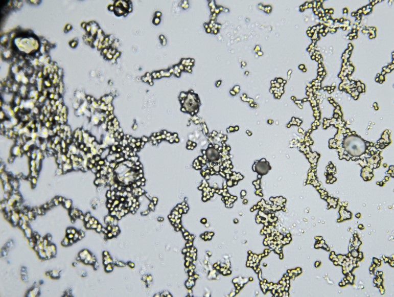 How to Spot, Prevent, and Safely Remove Mold in Your Home